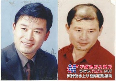 兰州哪里有专业的植发机构，兰州织发机构找哪家