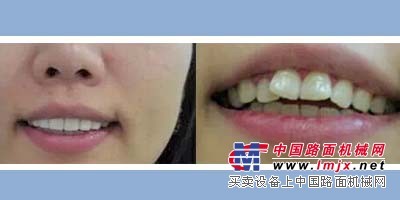 济宁牙套任城卞志强牙科诊所